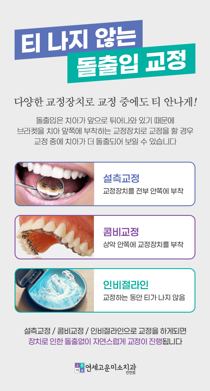 티 나지 않는 돌출입 교정 장치