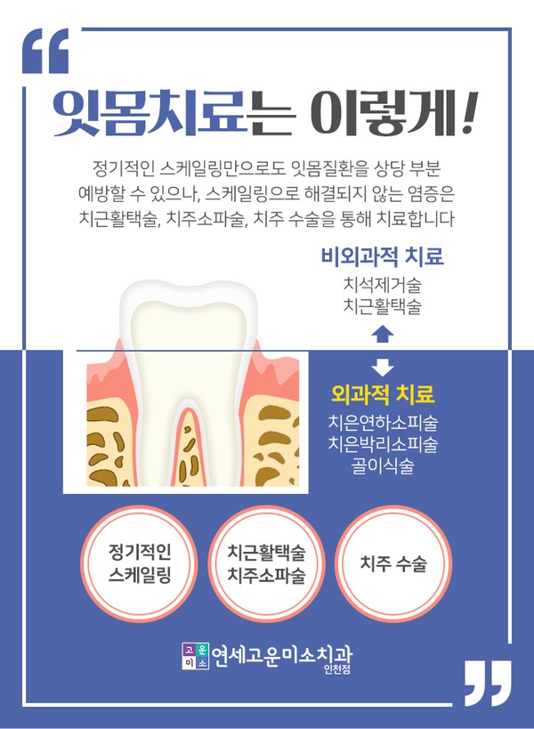 잇몸치료 방법 (비외과적 치료와 외과적 치료)