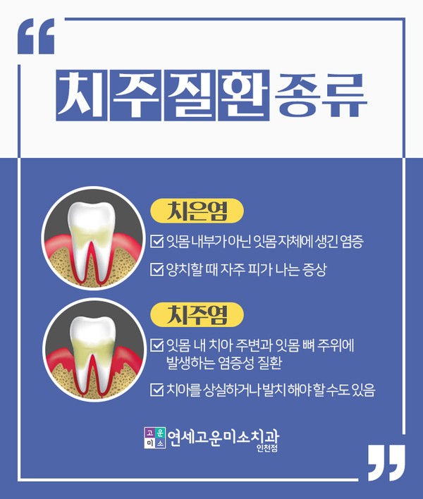 치은염과 치주염의 차이