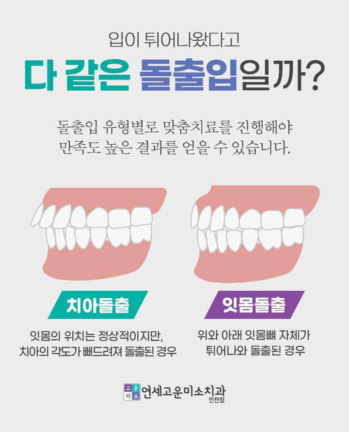치아 돌출과 잇몸뼈 돌출의 차이