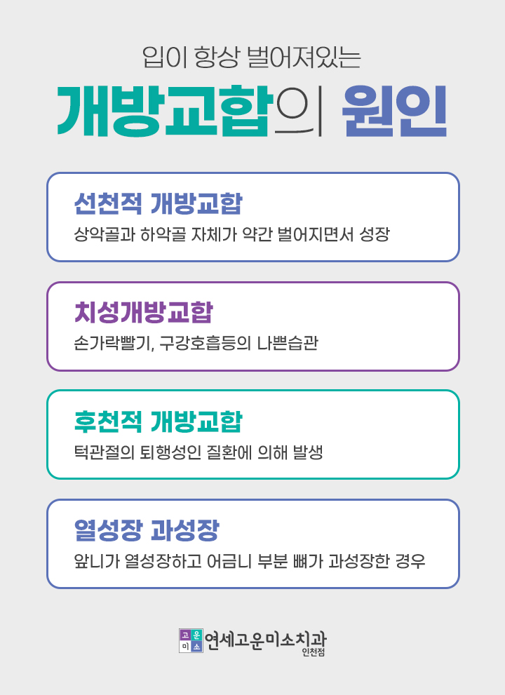 개방교합의 원인