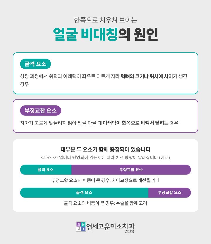 얼굴 비대칭의 원인