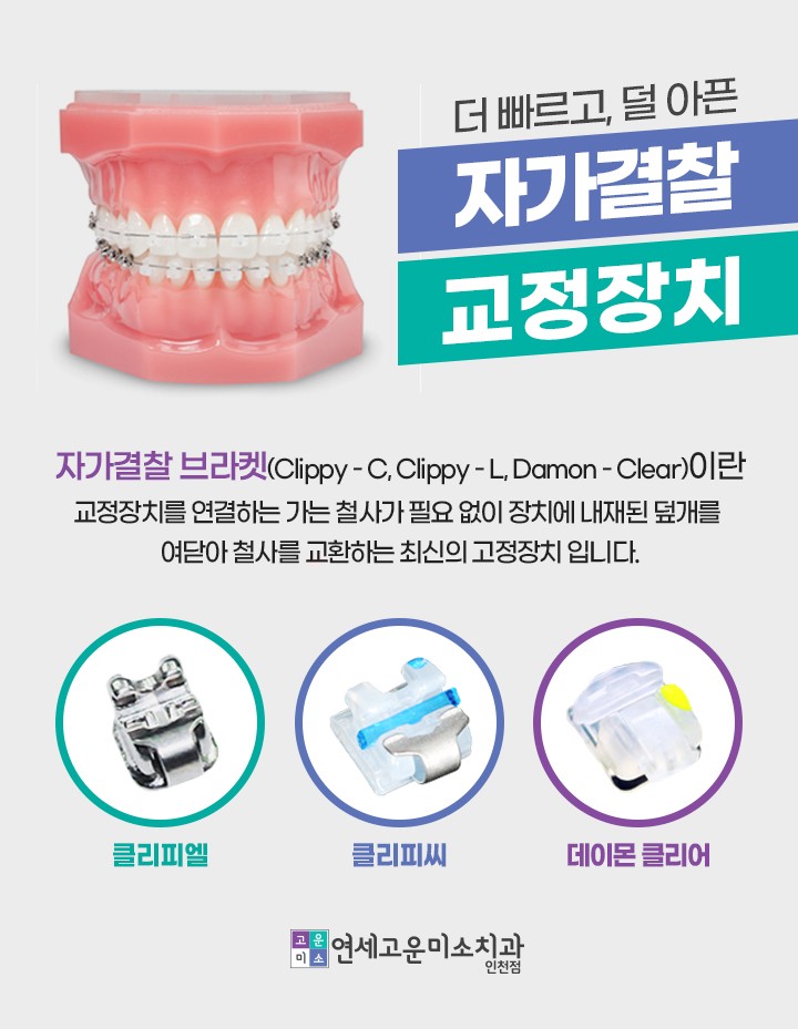 자가결찰 교정장치