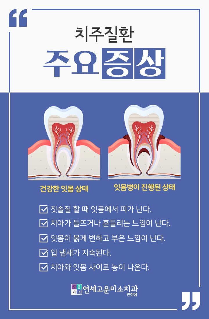 치주질환의 주요 증상