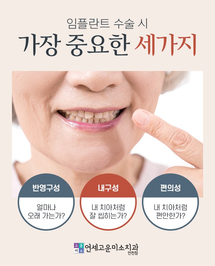 임플란트 수술 시 중요한 세 가지 (심미성, 내구성, 편의성)