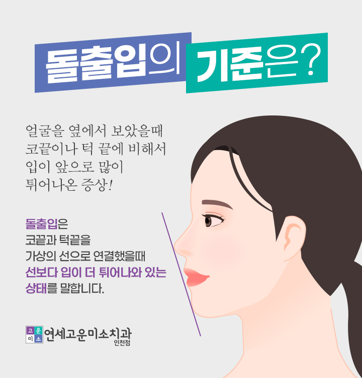코끝과 턱끝을 이은 선으로 보는 돌출입의 기준