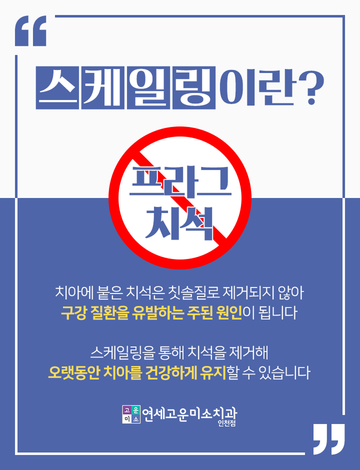 스케일링이란? 치석과 구강 질환의 관계
