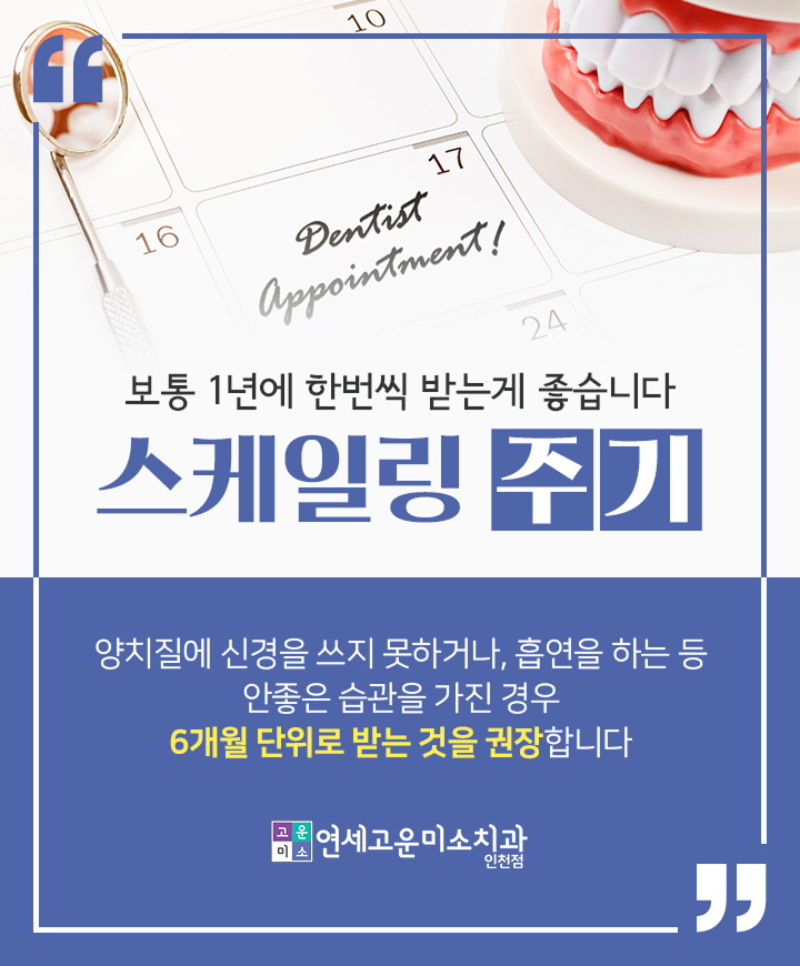 스케일링 예약 일정